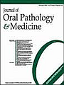 Journal of oral pathology and medicine